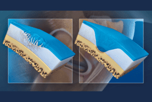PAAG for Intra-articular Therapy