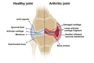 Reduce Friction to Support Joint Health